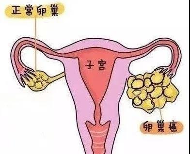 卵巢在肚脐什么位置图片